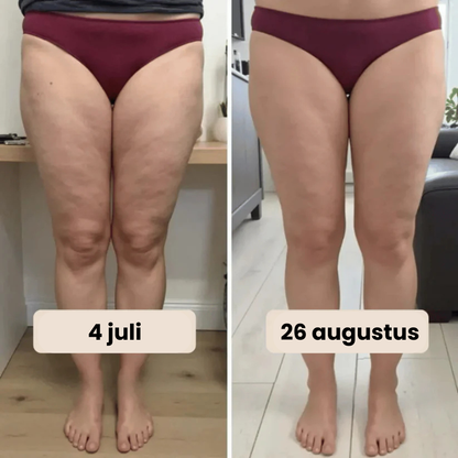 3D Anti-Cellulite Legging
